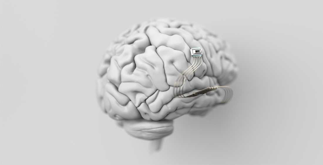 Implantes neuronales: ¿Podemos leer y escribir datos en los cerebros humanos?